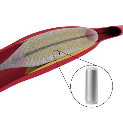 Spectra® MG Bio Balloon Catheter